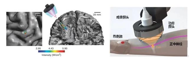 物理因子辅助运动和感觉康复的研究介绍与应用现状-5.jpg